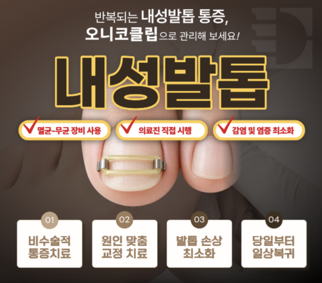 당산역 정형외과 내성발톱 발가락 찌릿한 통증 초기 원인과 비수술 치료법